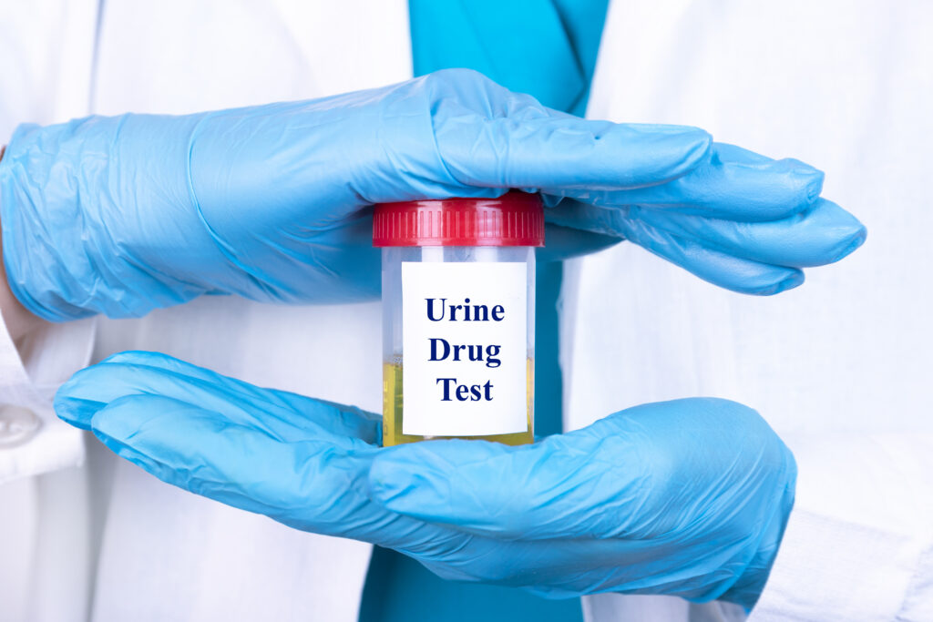 How Long Does Fentanyl Stay in Urine