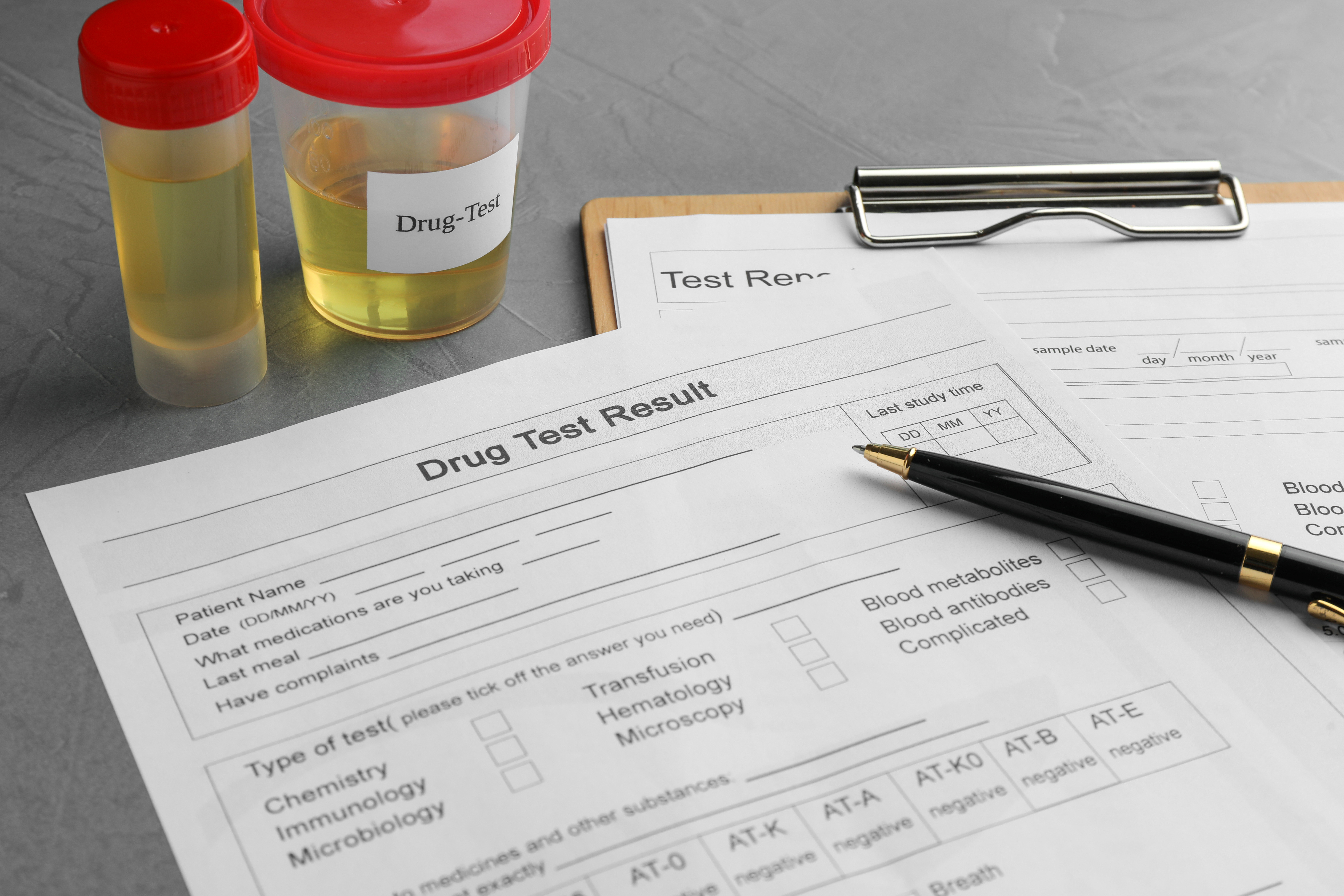 What Affects How Long Hydrocodone Stays in Urine?